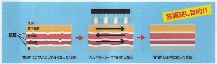 筋膜ムーブ電柱で筋膜にもアプローチ